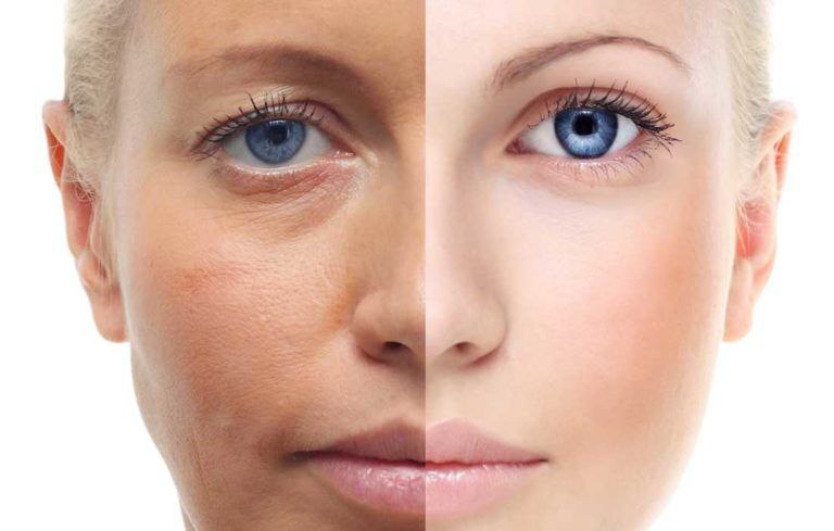 Витапластика