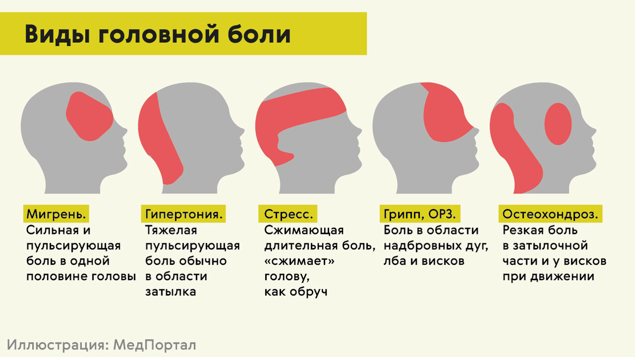 Боль в кадыке у женщин причины. Болит голова сзади пульсирует почему. Боль при нажатии на голову сзади. Болит голова в затылочной части. Причины головной боли.