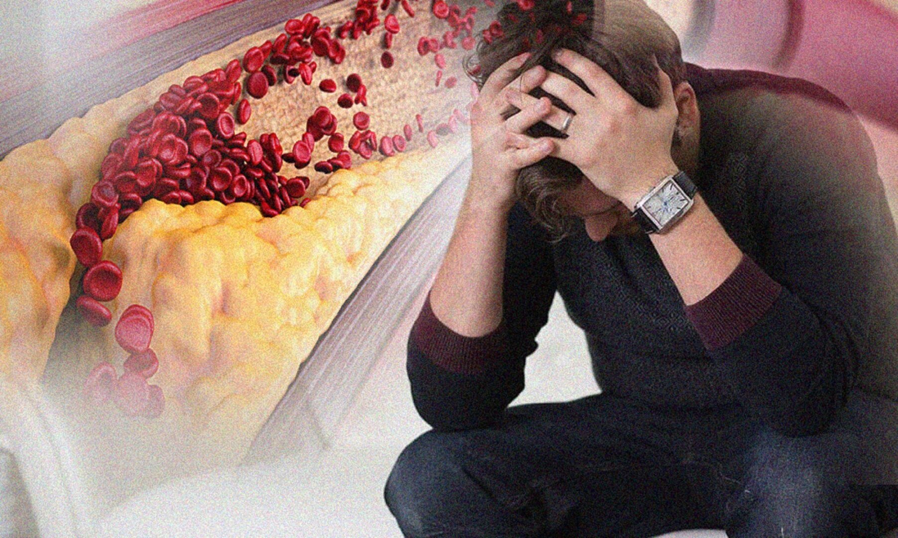 "Найден фактор, который может увеличить риск тяжелого атеросклероза в 1,8 раза"