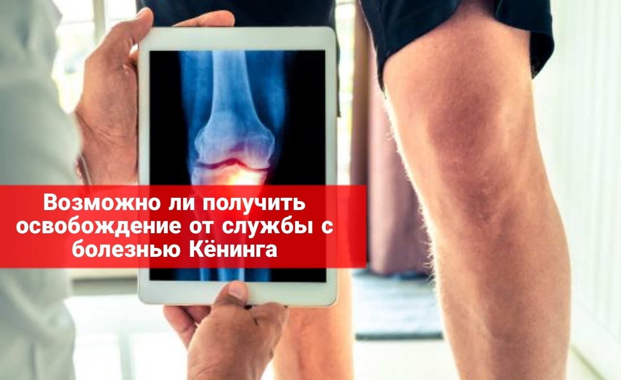 Возможно ли получить освобождение от службы с болезнью Кёнинга