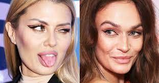 "Снесли челюсть": 5 самых жестоких драк российских звезд