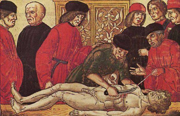 Безумные традиции Средневековья: Лечение эпилепсии кровью