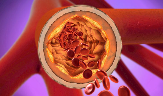 Что происходит во время сердечного приступа?