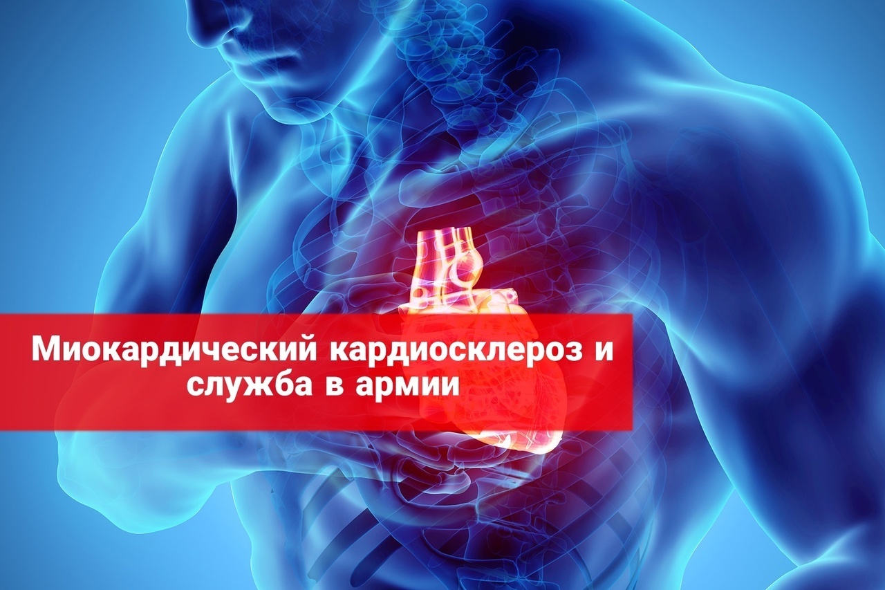 Миокардический склероз и служба в армии