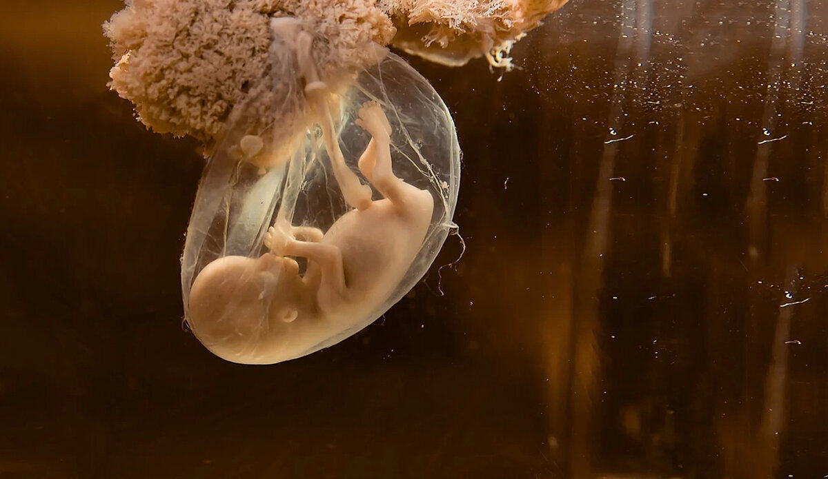 Прикладной психоанализ. Кто и как меня хотел убить, когда я ещё не родился!