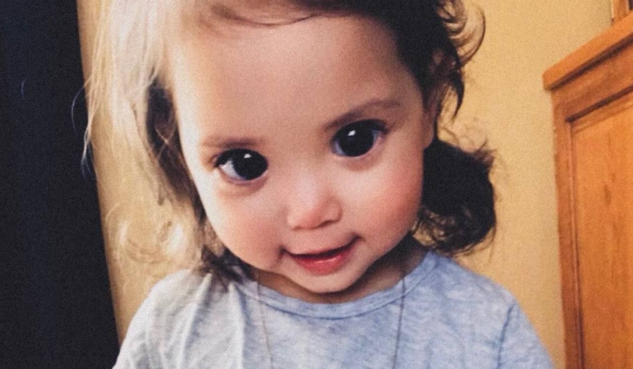 Синдром Аксенфельда-Ригера.