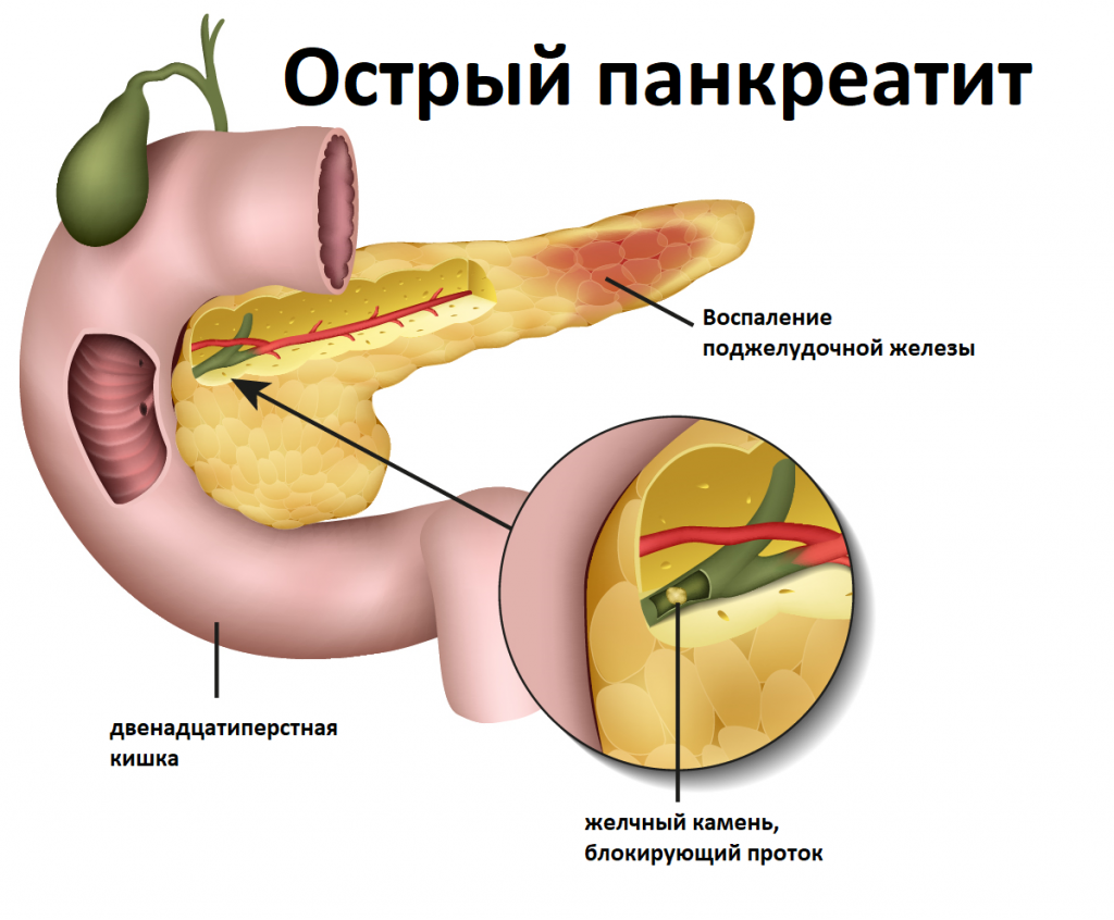 Диета при желчи в желудке