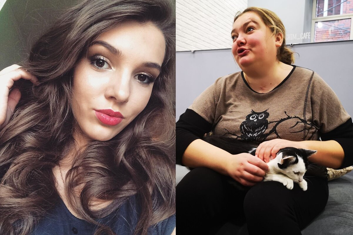 По вине жениха потеряла красоту и зрение, а он её бросил. Как сейчас живёт бывшая модель, попавшая в страшную аварию