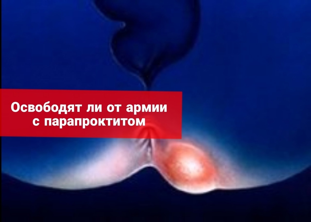 Берут ли в армию с парапроктитом