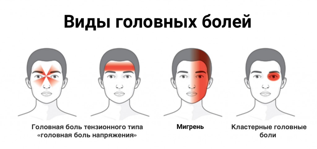 Сильную боль в голове. И как избавиться от сильной боли.