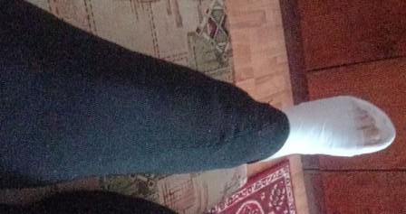 Друзья познаются в беде: одна нога на пять подруг