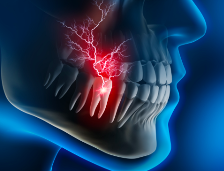 Стоматологический SOS. Быстрые домашние средства от зубной боли