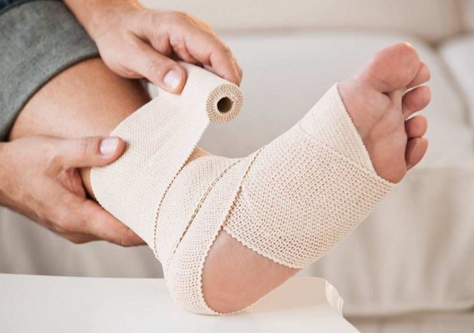 Применение эластичного бинта при варикозном расширении вен