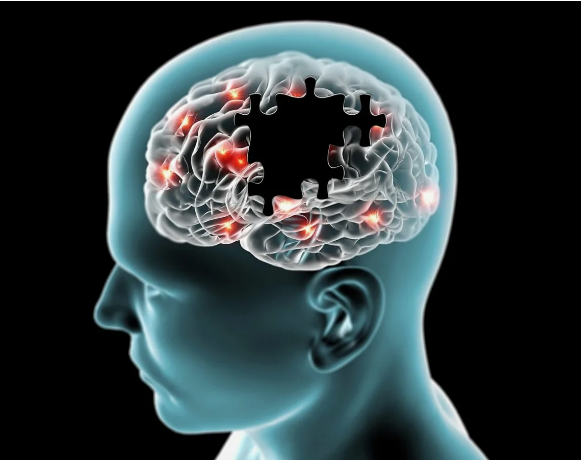 Защититься от деменции поможет сырая свекла