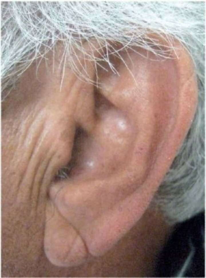 Знак Фрэнка