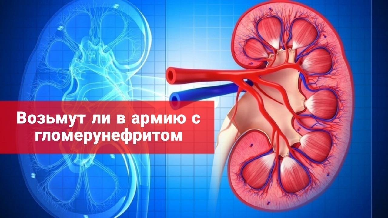 Возьмут ли в армию с гломерунефритом