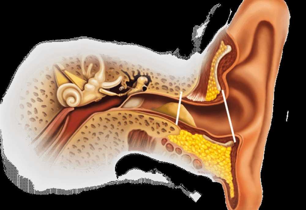Отит глухота. Буллёзный отит барабанная перепонка. Отомикоз серная пробка. Ушная сера в барабанной перепонке. Анатомия уха серная пробка.