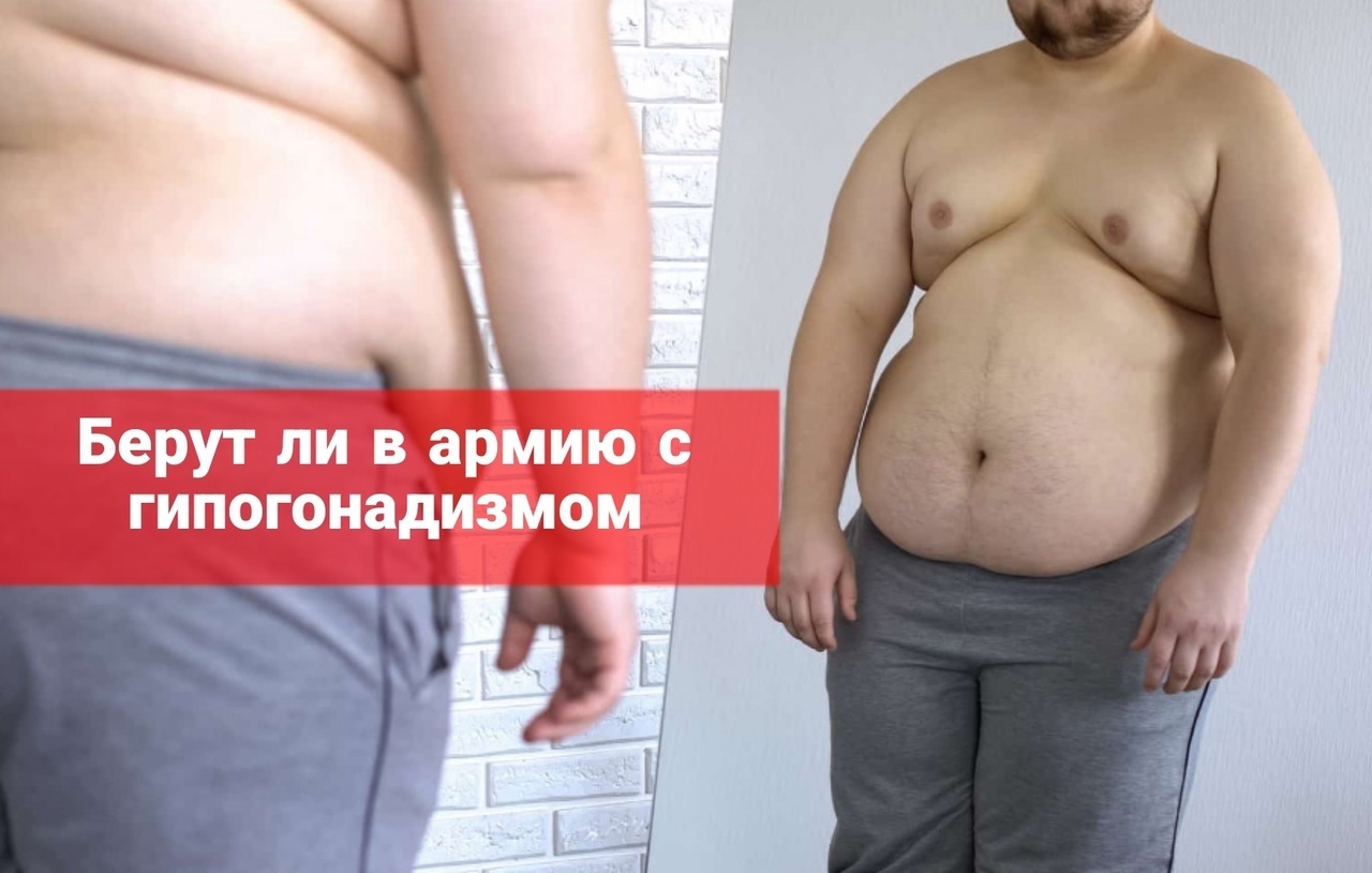 Берут ли в армию с гипогонадизмом