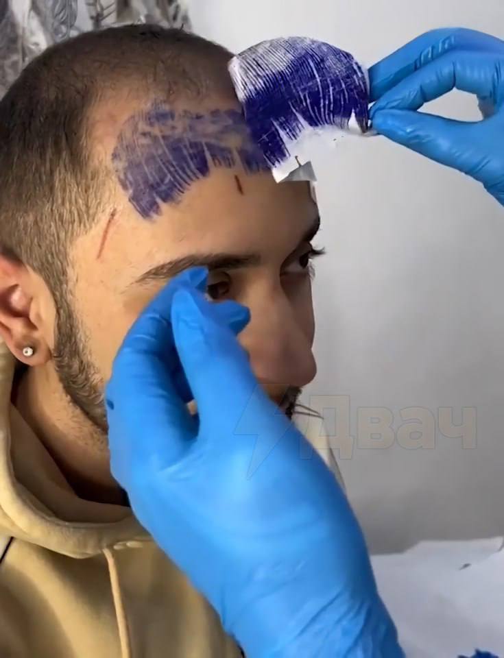 Итальянец решил набить себе татуху в виде чёлки, чтобы скрыть лысину.