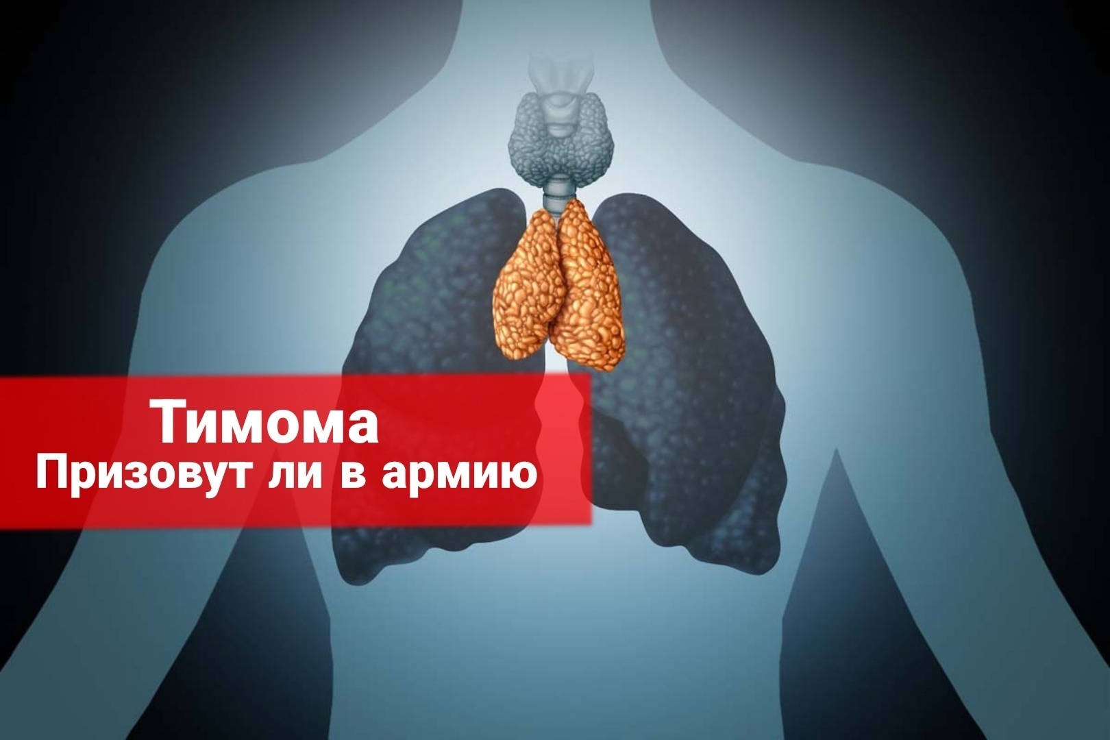 Берут ли в армию с тимомой