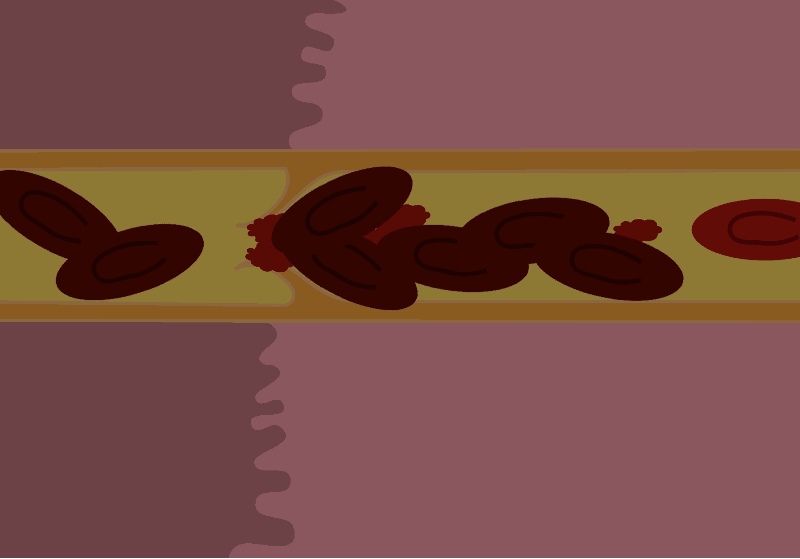 Бывает боль приятная. Бывает боль неприятная. Мое мнение.