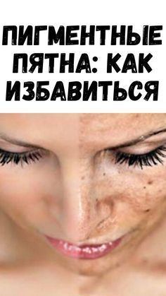 Как удалить пигментные пятна на коже .