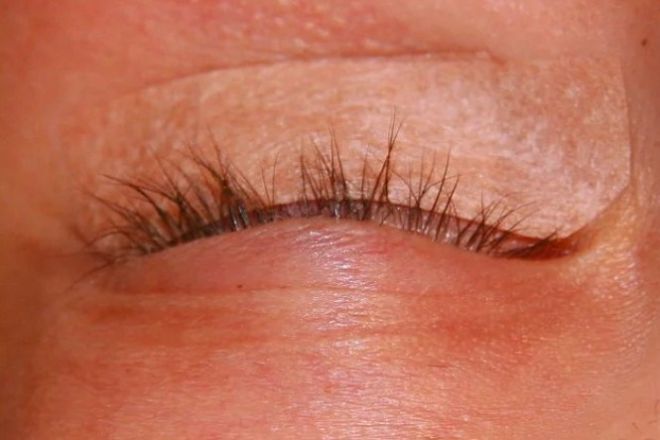 5 побочных эффектов наращивания ресниц.
