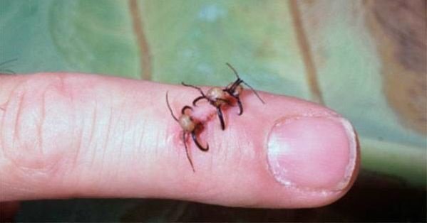 Какие животные убивают наиболее болезненно?