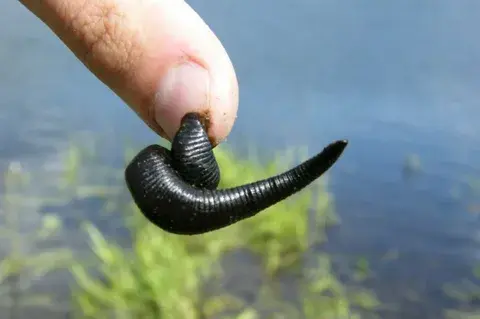 Что делать, если укусила пиявка?