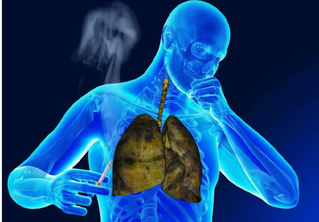 Связь или не связь? - пневмония и бронхит.