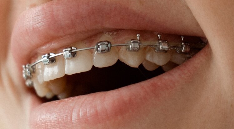 Как обманывают в стоматологии и разводят на деньги - 10 примеров