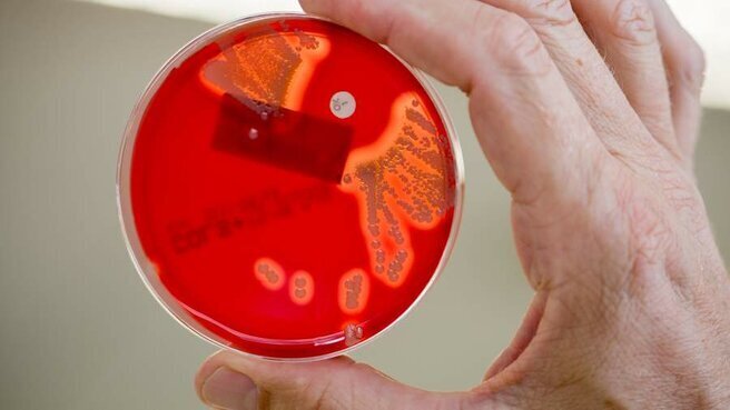 Будьте осторожны! В БАДах нашли опасные микроорганизмы и плесень