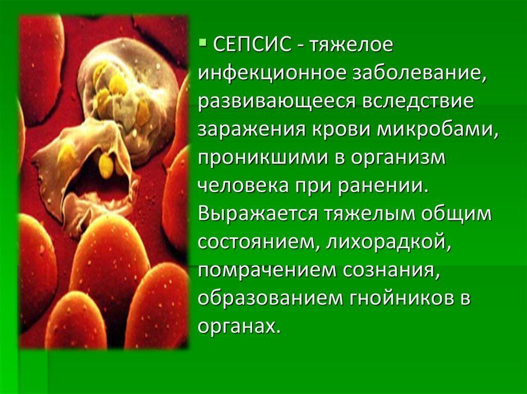 Что Такое Сепсис Фото