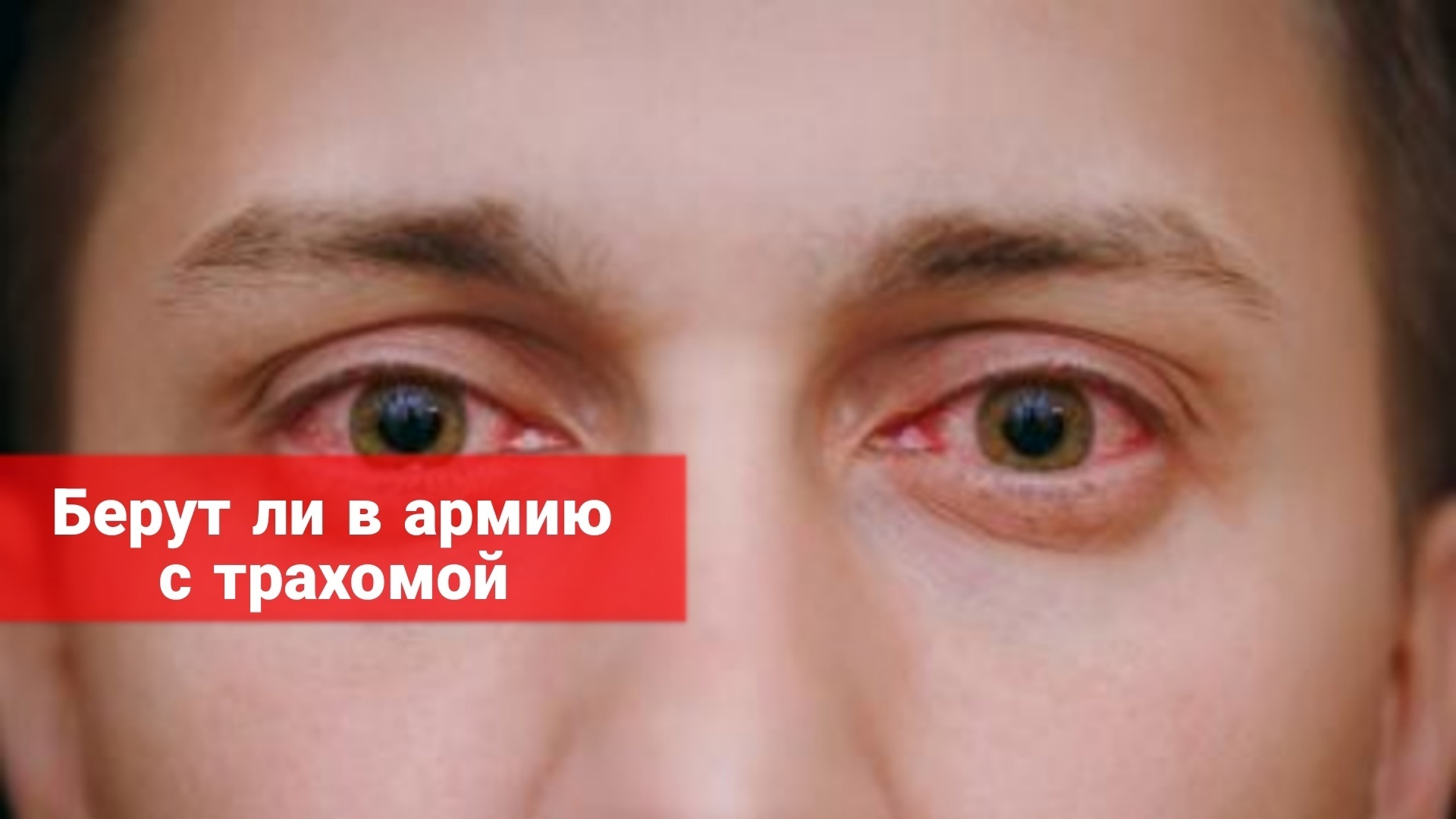 Берут ли в армию с трахомой