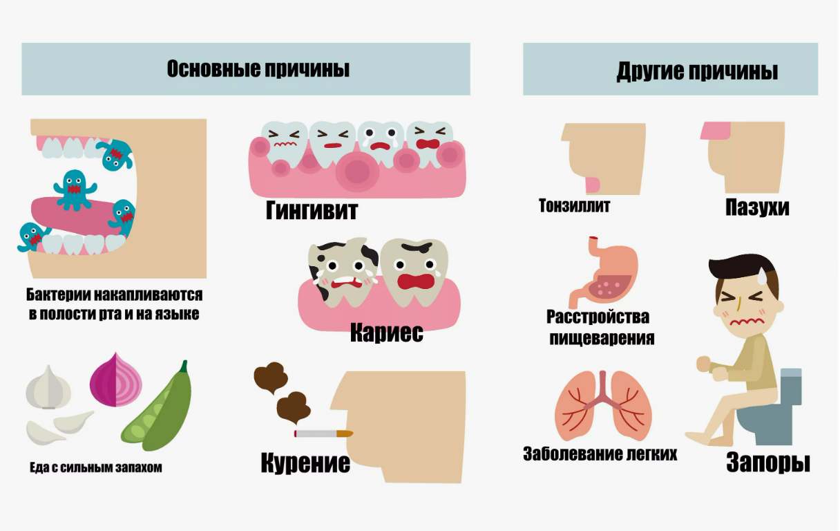 😒 Галитоз и галитофобия! Каждый второй на планете задаётся этим вопросом - как с этим жить дальше? Я помог (-ла) стоматологу выплатить ипотеку!