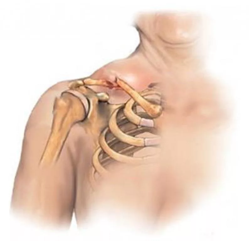 Последняя болезнь Николая I. Взгляд врача