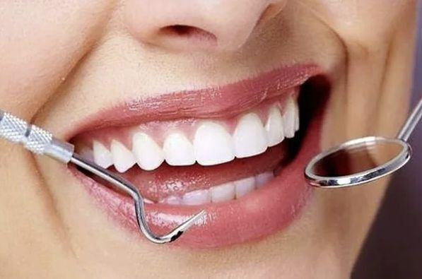 Секреты идеальной улыбки: отбеливание зубов