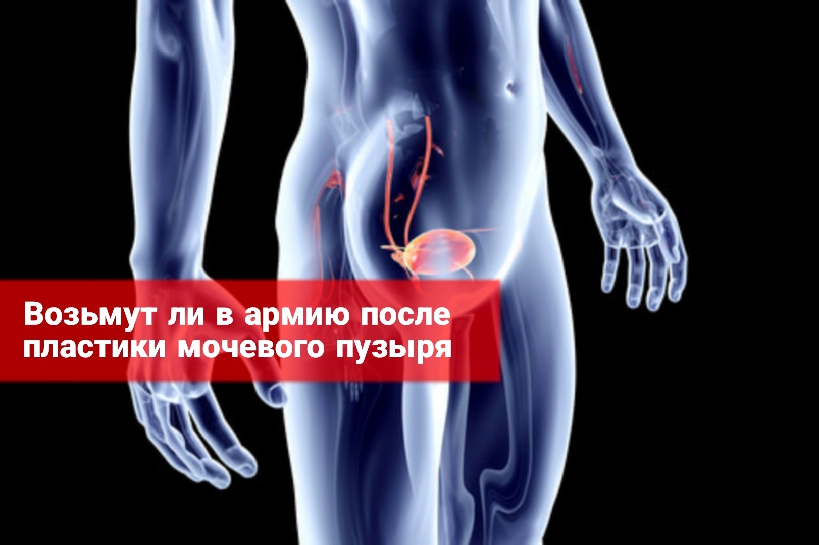 Возьмут ли в армию после пластики мочевого пузыря