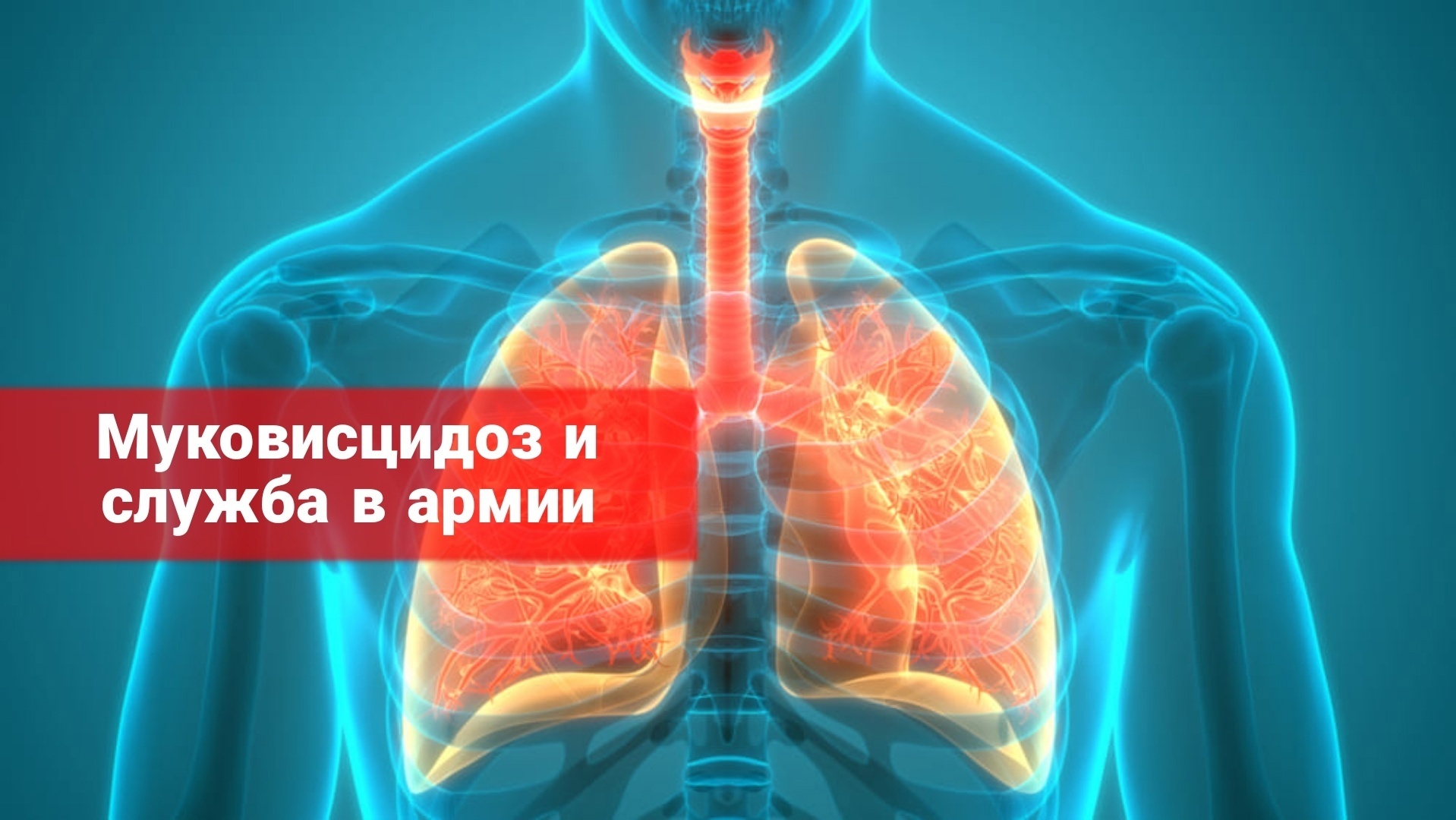 Муковисцидоз и служба в армии