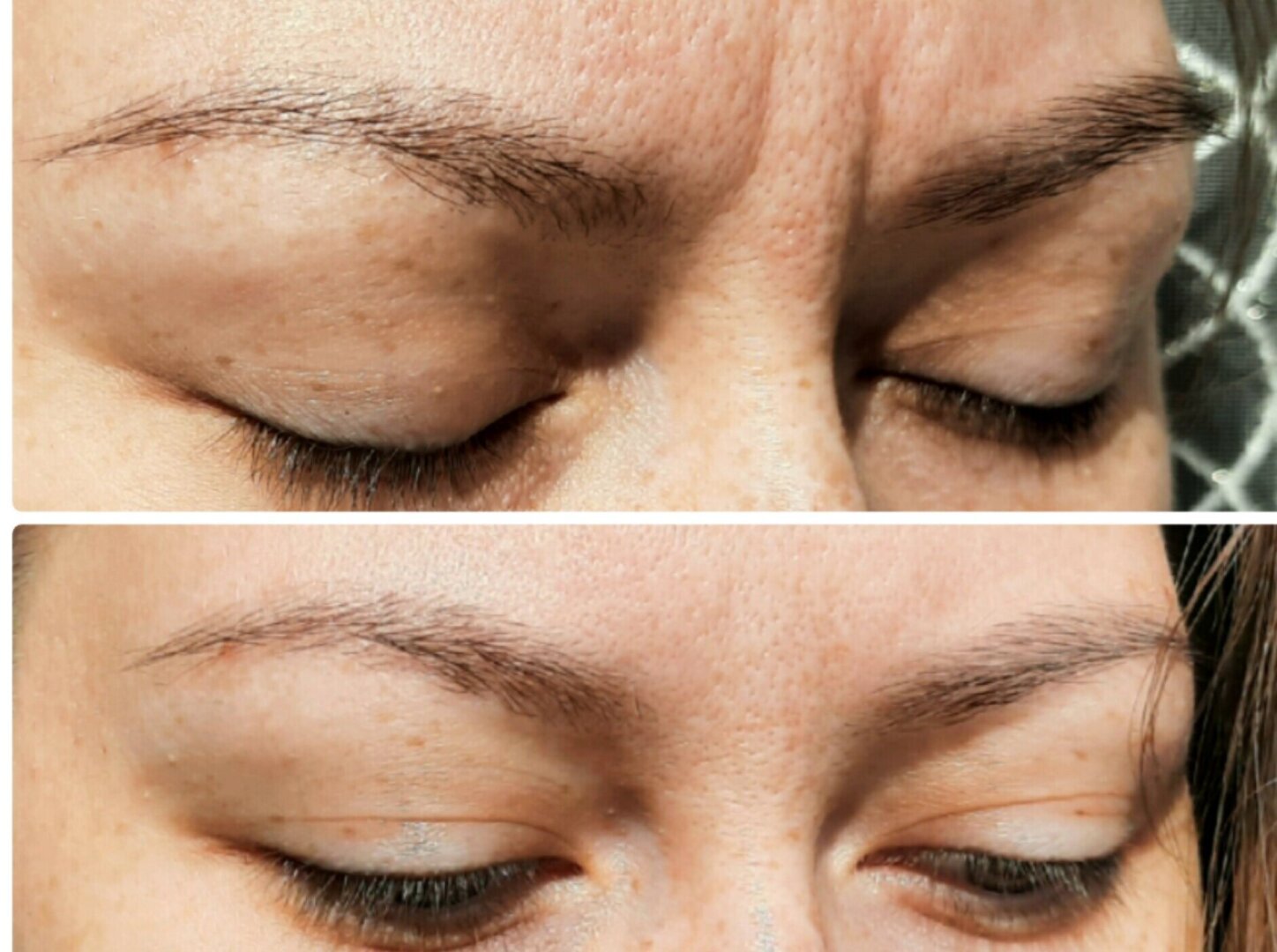 Избавилась от межбровки без уколов и дорогостоящих процедур