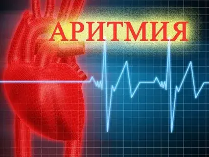 Необходимые процедуры, в случае возникновения аритмии.