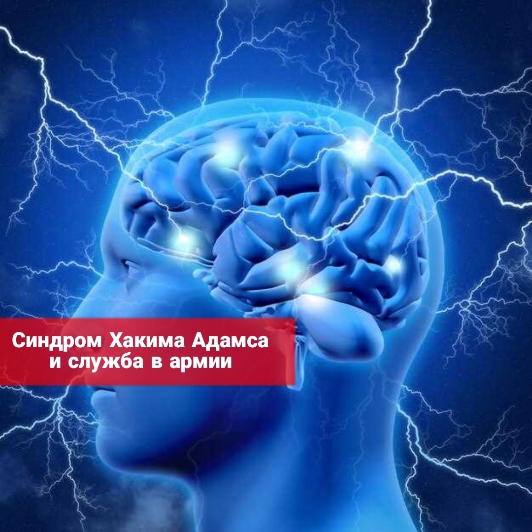 Синдром Хакима Адамса и служба в армии