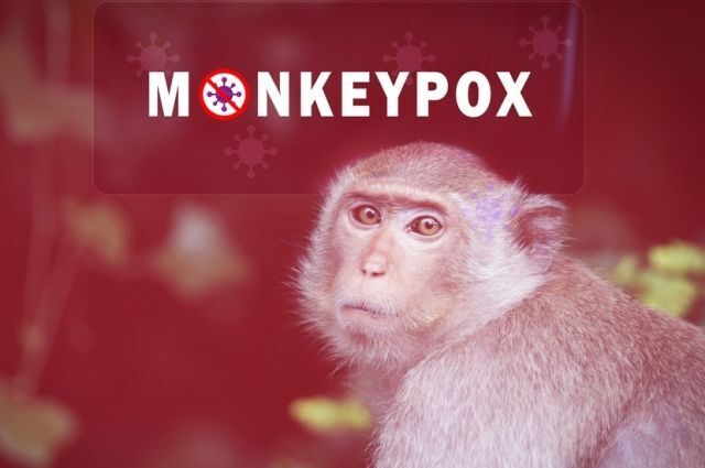 Оспа обезьян: ВОЗ объявляет эпидемию. Что нужно знать о этой болезни и ее распространении в России?