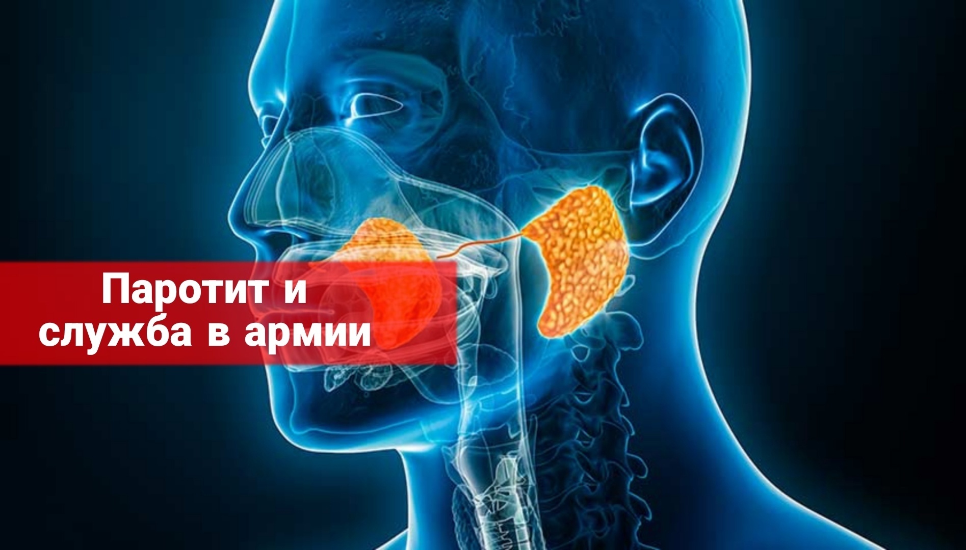 Паротит и служба в армии