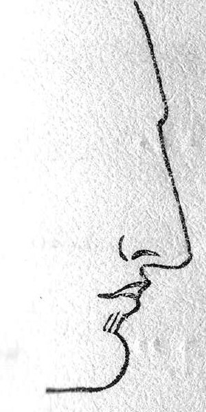 Снова течет кровь из носа. Идет кровь из носа. Месяцев 6 - 7 не текла. Но снова течет. Видать переработался просто.