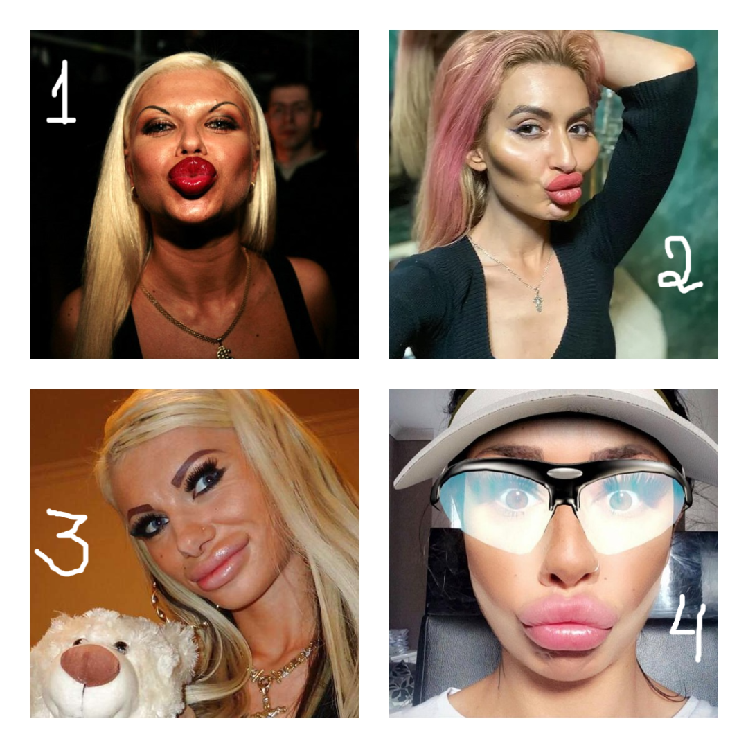 Голосуем за самые ужасные губы!