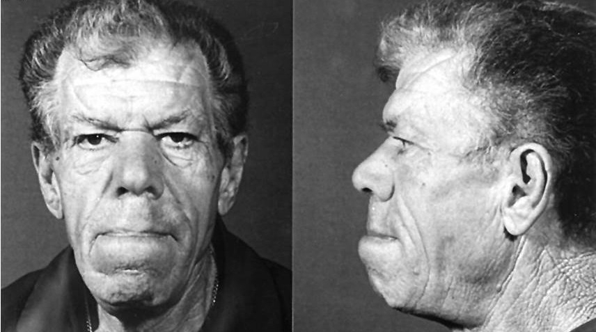 10 страшных болезней, которые безжалостно уродуют людей.