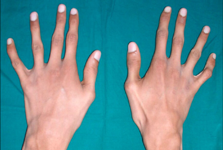 10 страшных болезней, которые безжалостно уродуют людей.