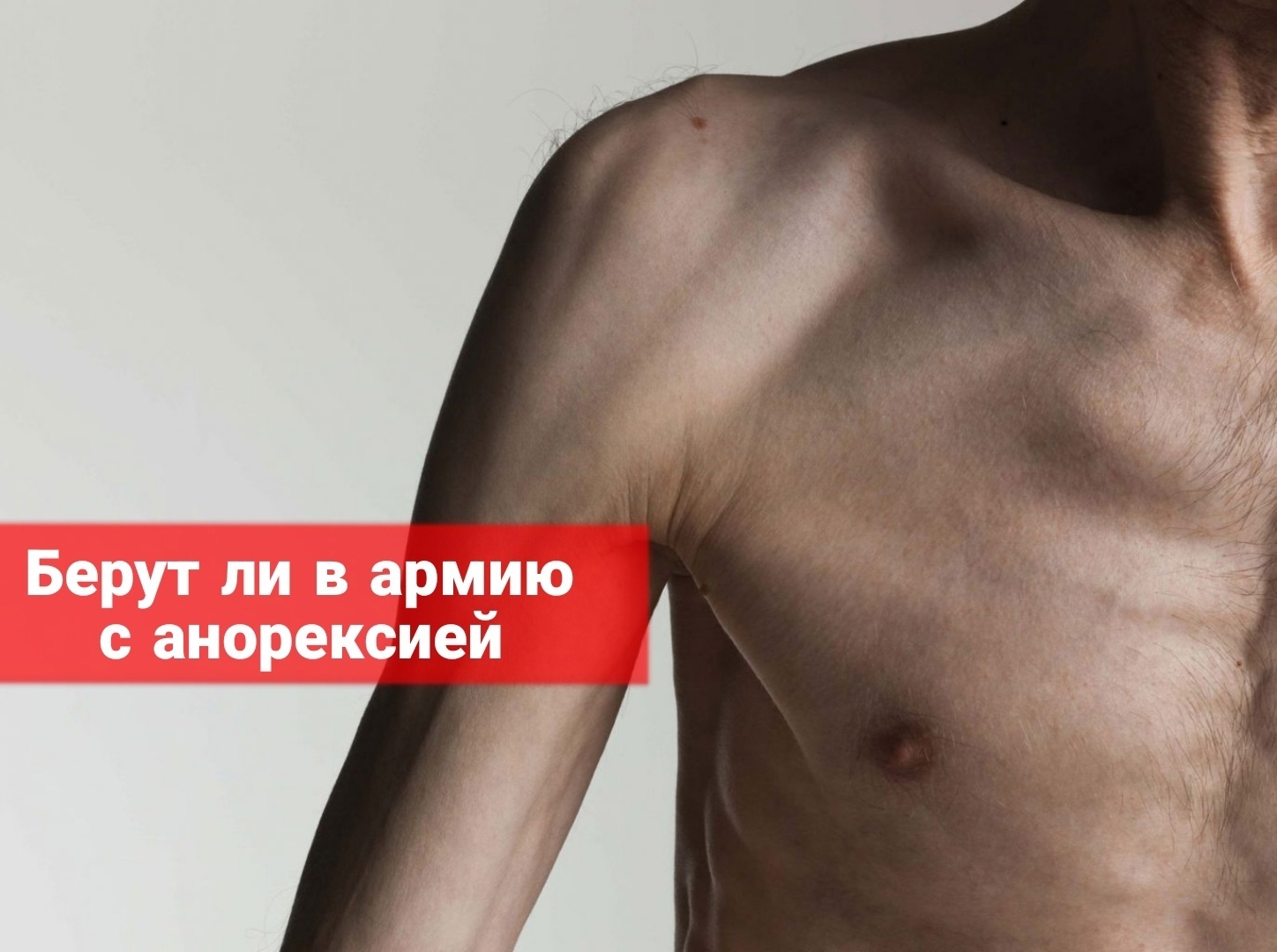 Берут ли в армию с анорексией