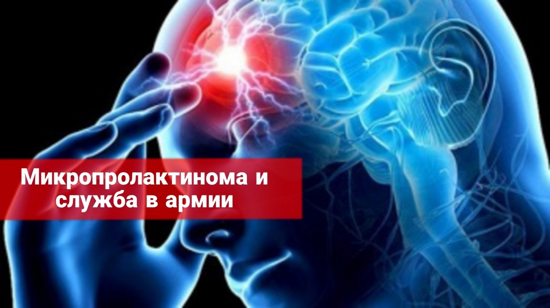 Микропролактинома и служба в армии